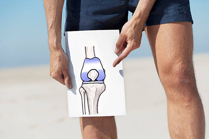 Knee Replacement